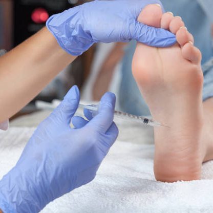 istockphoto-990310002-612x612 The doctor makes intramuscular injections of botulinum toxinon the feet of a woman against hyperhidrosis.