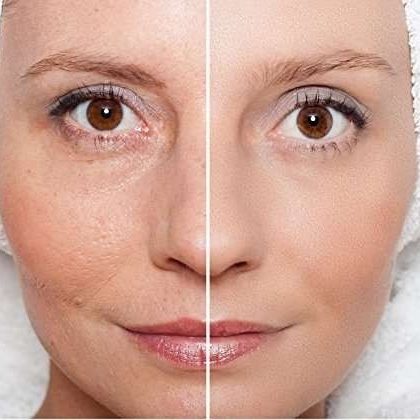 mesoterapia-facial-1-sesion-ccelulas-madreac-hialuronico-D_NQ_NP_846899-MLA27994653977_082018-F (1) mesoterapia-facial-1-sesion-ccelulas-madreac-hialuronico-D_NQ_NP_846899-MLA27994653977_082018-F (1)