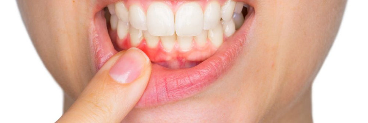 periodoncia