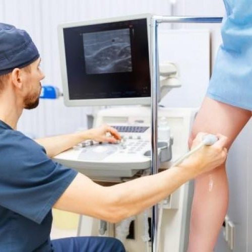 varices1